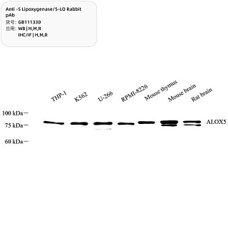 Антитела первичные, поликлональные кролика к 5 Lipoxygenase/5-LO крысы, мыши, человека, 100 мкл