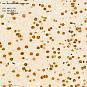 Антитела первичные, поликлональные, Neurofibromin, 100 мкл