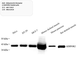 Антитела первичные, поликл. кролика к Adiponectin Receptor 2/ADIPOR2 крысы, мыши, человека, 100 мкл
