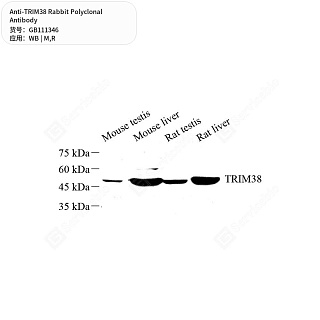 Антитела первичные, поликлональные кролика к TRIM38 крысы, мыши, 50 мкл