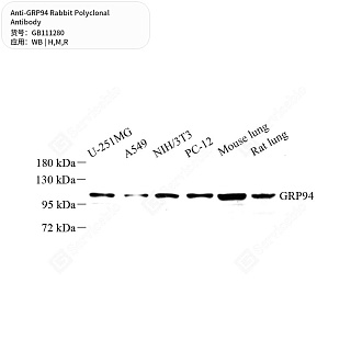 Антитела первичные, поликлональные кролика к GRP94 крысы, мыши, человека, 50 мкл