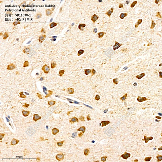 Антитела первичные, поликлональные кролика к Acetylcholinesterase крысы, мыши, 50 мкл