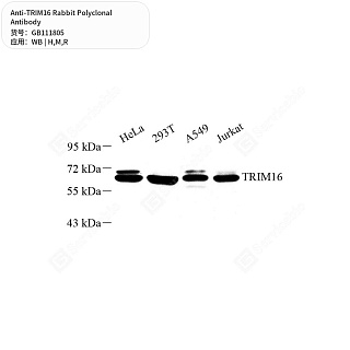 Антитела первичные, поликлональные кролика к TRIM16 крысы, мыши, человека, 50 мкл