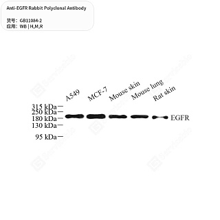 Антитела первичные, поликлональные кролика к EGFR крысы, мыши, человека, 50 мкл