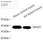 Антитела первичные, поликлональные, TNNT3, 100 мкл
