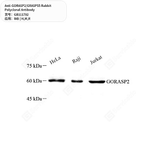 Антитела первичные, поликлональные кролика к GORASP2/GRASP55 крысы, мыши, человека, 50 мкл