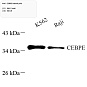 Антитела первичные, поликлональные, CEBPE, 100 мкл