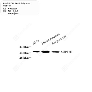 Антитела первичные, поликлональные кролика к SUPT3H крысы, мыши, человека, 50 мкл