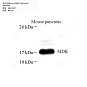 Антитела первичные, поликлональные кролика к Midkine мыши, 100 мкл