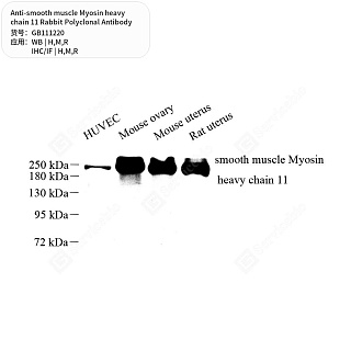 Антитела первичные, пол. крол. к smooth muscle Myosin heavy chain 11 крысы, мыши, человека, 50 мкл