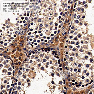 Антитела первичные, поликлональные кролика к Angiotensin Converting Enzyme 1 крысы, мыши, 50 мкл