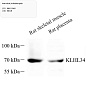 Антитела первичные, поликлональные, KLHL34, 100 мкл