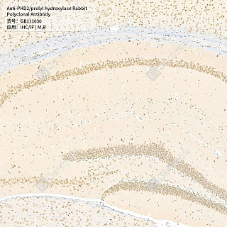Антитела первичные, поликлональные кролика к PHD2/prolyl hydroxylase крысы, мыши, 50 мкл