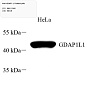 Антитела первичные, поликлональные, GDAP1-L1, 100 мкл