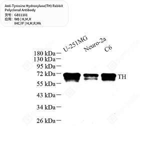 Антитела первичные, пол. кролика к Tyrosine Hydroxylase(TH) крысы, мыши, обезьяны, человека, 50 мкл