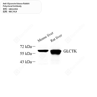Антитела первичные, поликлональные кролика к Glycerate kinase крысы, мыши, 50 мкл