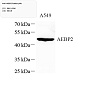 Антитела первичные, поликлональные, AEBP2, 100 мкл