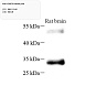 Антитела первичные, поликлональные, CNOT9, 100 мкл