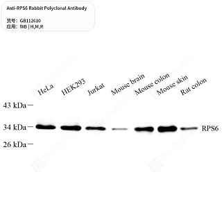 Антитела первичные, поликлональные кролика к RPS6 крысы, мыши, человека, 50 мкл