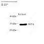 Антитела первичные, поликлональные кролика к SGTA крысы, 100 мкл