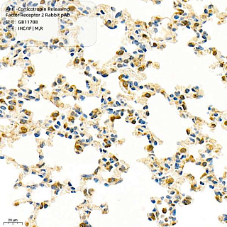 Антитела первичные, полик. крол. к Corticotropin Releasing Factor Receptor 2 крысы, мыши, 100 мкл