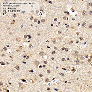 Антитела первичные, поликлональные кролика к Superoxide Dismutase 1 крысы, мыши, человека, 50 мкл