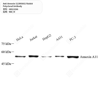Антитела первичные, поликлональные кролика к Annexin-11/ANXA11 человека, 50 мкл