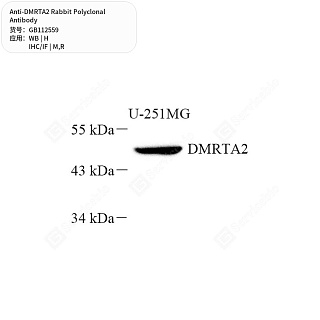 Антитела первичные, поликлональные кролика к DMRTA2 крысы, мыши, человека, 50 мкл