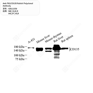Антитела первичные, поликлональные кролика к Flt3/CD135 крысы, мыши, человека, 50 мкл