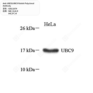 Антитела первичные, поликлональные кролика к UBE2I/UBC9 крысы, мыши, человека, 50 мкл