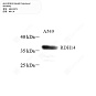 Антитела первичные, поликлональные кролика к RDH14 человека, 50 мкл