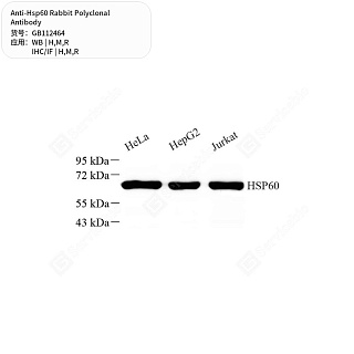 Антитела первичные, поликлональные кролика к Hsp60 крысы, мыши, человека, 50 мкл