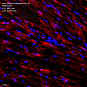 Антитела первичные, поликлональные, Glucose Transporter GLUT4, 100 мкл