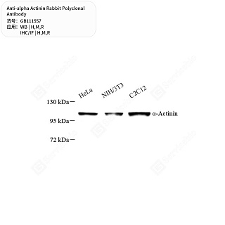 Антитела первичные, поликлональные кролика к alpha Actinin крысы, мыши, человека, 50 мкл