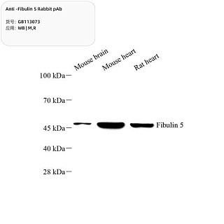 Антитела первичные, поликлональные кролика к Fibulin 5 крысы, мыши, 100 мкл