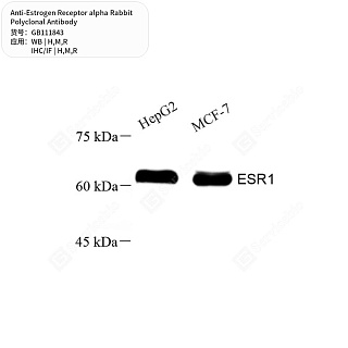 Антитела первичные, поликлональные кролика к Estrogen Receptor alpha крысы, мыши, человека, 50 мкл