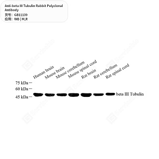 Антитела первичные, поликлональные кролика к beta III Tubulin крысы, мыши, 50 мкл