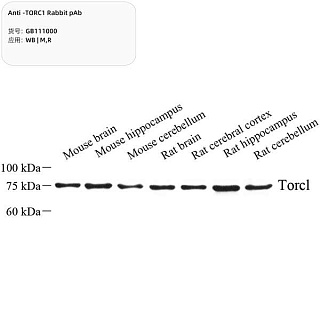 Антитела первичные, поликлональные, USP27X, 100 мкл