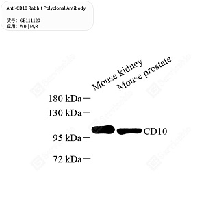 Антитела первичные, поликлональные кролика к CD10 крысы, мыши, 50 мкл