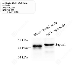 Антитела первичные, поликлональные кролика к Septin-1 крысы, мыши, человека, 50 мкл