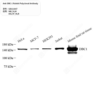 Антитела первичные, поликлональные кролика к DBC-1 крысы, мыши, человека, 50 мкл