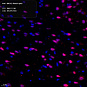 Антитела первичные, поликлональные, BRCA2, 100 мкл
