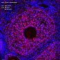 Антитела первичные, поликлональные, ZC3H11A, 100 мкл