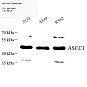 Антитела первичные, поликлональные, ASCC1, 100 мкл