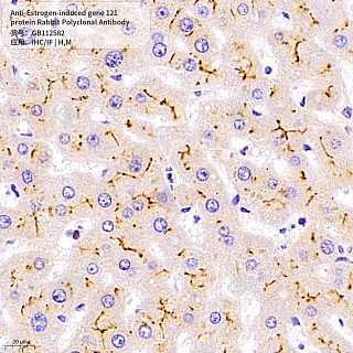 Антитела первичные, поликл. кролика к Estrogen-induced gene 121 protein мыши, человека, 50 мкл
