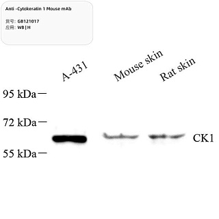 Антитела первичные, моноклональные мыши к Cytokeratin 1 крысы, мыши, человека, 100 мкл
