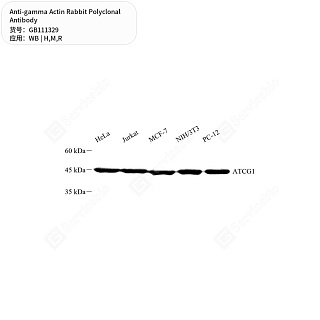 Антитела первичные, поликлональные кролика к gamma Actin крысы, мыши, человека, 50 мкл