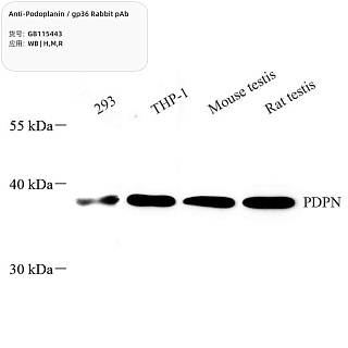 Антитела первичные, поликлональные кролика к Podoplanin/gp36 крысы, мыши, человека, 100 мкл