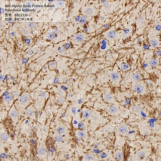Антитела первичные, поликлональные кролика к Myelin Basic Protein крысы, мыши, 50 мкл