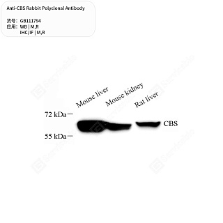 Антитела первичные, поликлональные кролика к CBS крысы, мыши, 50 мкл